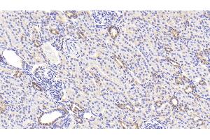 Detection of LDHB in Human Kidney Tissue using Polyclonal Antibody to Lactate Dehydrogenase B (LDHB) (LDHB 抗体  (AA 1-334))