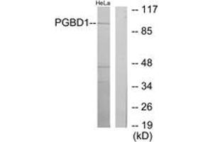 Western blot analysis of extracts from HeLa cells, using PGBD1 Antibody. (PGBD1 抗体  (AA 241-290))
