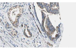 ABIN6277641 at 1/100 staining Human prostate tissue by IHC-P. (ATIC 抗体  (C-Term))
