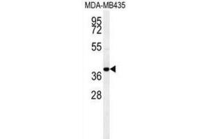 Western Blotting (WB) image for anti-Chemokine (C-C Motif) Receptor 8 (CCR8) antibody (ABIN2995670) (CCR8 抗体)