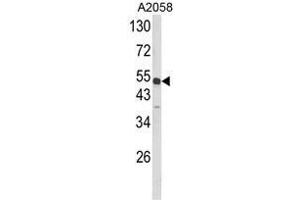 Western blot analysis of ANXA7 Antibody (Center) in A2058 cell line lysates (35ug/lane). (Annexin VII 抗体  (Middle Region))