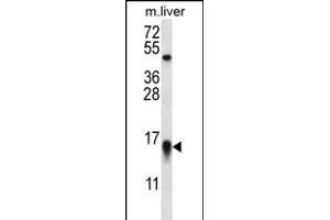 MYCBP Antibody (N-term) (ABIN656344 and ABIN2845643) western blot analysis in mouse liver tissue lysates (35 μg/lane). (MYCBP 抗体  (N-Term))
