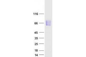 Western Blotting (WB) image for Mucosal Vascular Addressin Cell Adhesion Molecule 1 (MADCAM1) (Transcript Variant 1) protein (Myc-DYKDDDDK Tag) (ABIN2725142)