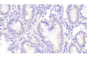 Detection of TECK in Human Small intestine Tissue using Polyclonal Antibody to Thymus Expressed Chemokine (TECK) (CCL25 抗体  (AA 24-150))