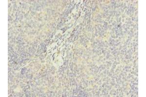 Immunohistochemistry of paraffin-embedded human tonsil tissue using ABIN7144990 at dilution of 1:100 (DDX42 抗体  (AA 519-819))