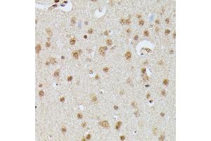 Immunohistochemistry (IHC) image for anti-Immunoglobulin mu Binding Protein 2 (IGHMBP2) (AA 540-720) antibody (ABIN7267848)