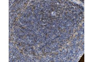 IHC analysis of SELPLG using anti-SELPLG antibody (ABIN7600341).