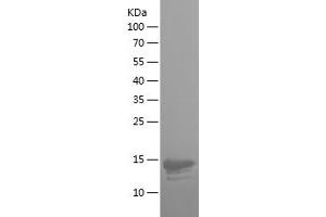 Western Blotting (WB) image for Integrin beta 7 (ITGB7) (AA 71-172) protein (His tag) (ABIN7123474) (Integrin beta 7 Protein (ITGB7) (AA 71-172) (His tag))