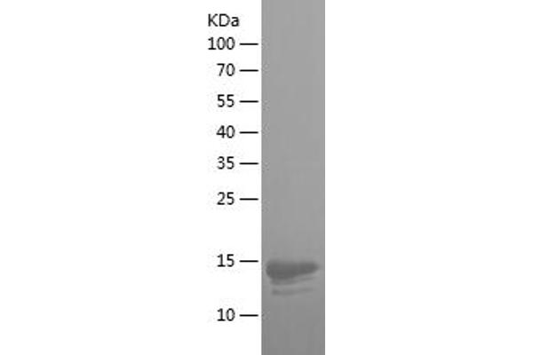 Integrin beta 7 Protein (ITGB7) (AA 71-172) (His tag)