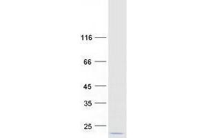 Western Blotting (WB) image for Peripheral-Type Benzodiazepine Receptor (TSPO) (Transcript Variant PBR) protein (Myc-DYKDDDDK Tag) (ABIN2734451)