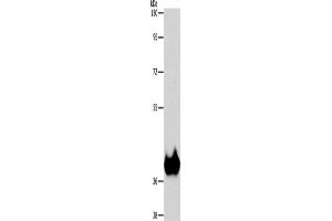 Western Blotting (WB) image for anti-Aspartoacylase (ASPA) antibody (ABIN2429545) (ASPA 抗体)