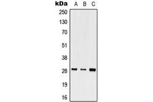 Western blot analysis of SHOX expression in HEK293T (A), Raw264. (SHOX 抗体  (Center))