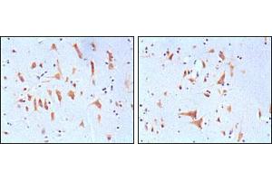 Immunohistochemical analysis of paraffin-embedded human brain tissues, showing cytoplasmic localization with DAB staining using FMR1 mouse mAb. (FMR1 抗体)