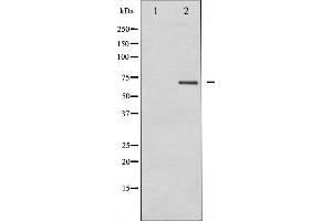 Western blot analysis of PKCB expression in HeLa whole cell lysates,The lane on the left is treated with the antigen-specific peptide. (PKC beta 抗体  (C-Term))