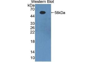 Western Blotting (WB) image for anti-Fibrinogen beta Chain (FGB) (AA 29-491) antibody (ABIN1858852) (Fibrinogen beta Chain 抗体  (AA 29-491))