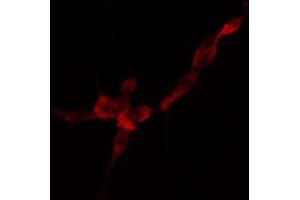 ABIN6274757 staining HuvEc cells by IF/ICC. (RPS4Y1 抗体)