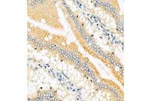 Immunohistochemistry (Paraffin-embedded Sections) (IHC (p)) image for anti-ATPase, Ca++ Transporting, Plasma Membrane 1 (ATP2B1) antibody (ABIN7073155)