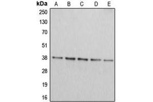 Western blot analysis of Arginase 2 expression in Jurkat (A), HepG2 (B), HEK293T (C), A549 (D), PC12 (E) whole cell lysates. (ARG2 抗体  (C-Term))