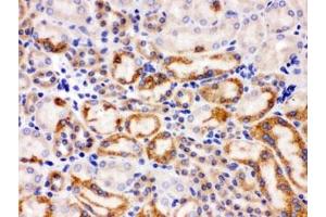 IHC testing of FFPE mouse kidney with SLC22A2 antibody. (WNT7A 抗体)