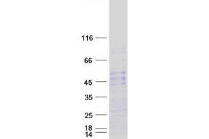 NOTUM Protein (Myc-DYKDDDDK Tag)