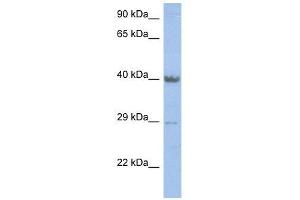 ZNF474 antibody used at 2. (ZNF474 抗体  (Middle Region))