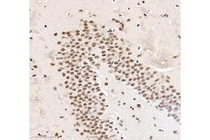 Immunohistochemistry of paraffin embedded rat hippocampus using RBM8A (ABIN7075478) at dilution of 1: 300 (300x lens)