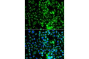 Immunofluorescence analysis of A549 cell using EPHA1 antibody. (EPHA1 抗体)