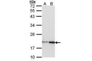 Image no. 1 for anti-Non-Metastatic Cells 1, Protein (NM23A) Expressed in (NME1) (AA 1-120) antibody (ABIN467572) (NME1 抗体  (AA 1-120))