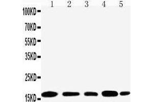 Anti-TIA1 antibody, Western blotting Lane 1: JURKAT Cell Lysate Lane 2: RAJI Cell Lysate Lane 3: CEM Cell Lysate Lane 4:  Cell Lysate Lane 5: K562 Cell Lysate (TIA1 抗体  (N-Term))