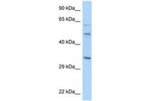 Image no. 1 for anti-Williams Beuren Syndrome Chromosome Region 22 (WBSCR22) (AA 200-249) antibody (ABIN6748061) (WBSCR22 抗体  (AA 200-249))