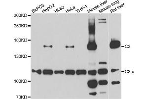 Western blot analysis of extracts of various cell lines, using C3 antibody (ABIN5975433) at 1/1000 dilution. (C3 抗体)