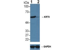 Rabbit Detection antibody from the kit in WB with Positive Control:  Sample Knockout Varification: Lane 1: Wild-type Hela cell lysate; Lane 2: KRT8 knockout Hela cell lysate;. (KRT8 ELISA 试剂盒)