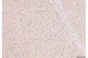 IHC analysis of NDUFB8 using anti-NDUFB8 antibody (ABIN7599048).