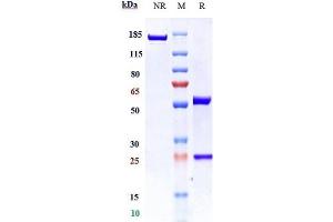 Anti-TLR3 / CD283 Reference Antibody (CNTO5429) on SDS-PAGE under reducing (R) condition.