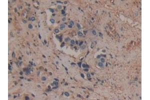Immunohistochemistry (IHC) image for anti-Annexin A6 (ANXA6) (AA 2-251) antibody (ABIN7434836)