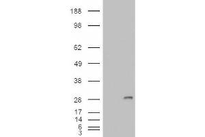 Image no. 2 for anti-Insulin-Like Growth Factor Binding Protein 6 (IGFBP6) (Internal Region) antibody (ABIN374965) (IGFBP6 抗体  (Internal Region))