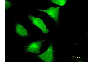 Immunofluorescence of monoclonal antibody to CNTN4 on HeLa cell. (Contactin 4 抗体  (AA 800-898))
