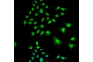Immunofluorescence analysis of U2OS cells using UBE3C Polyclonal Antibody (UBE3C 抗体)