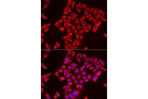 Immunofluorescence analysis of HeLa cells using ST3GAL3 antibody. (ST3GAL3 抗体  (AA 30-375))