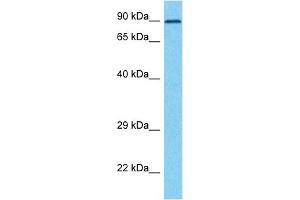 Host:  Rabbit  Target Name:  ZP2  Sample Type:  HT1080 Whole Cell lysates  Antibody Dilution:  1. (ZP2 抗体  (C-Term))