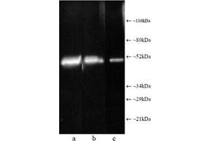 Western blot analysis: Composite luminograph of (a) HeLa S3 cytosolic preparation, (b) purified 26S proteasome, and (c) human placental proteasome fraction after SDS PAGE followed by blotting onto PVDF membrane and probing with antibody . (Proteasome 19S Rpt1/S7 Subunit 抗体)