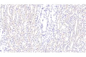 Detection of CCND1 in Rat Kidney Tissue using Polyclonal Antibody to Cyclin D1 (CCND1) (Cyclin D1 抗体  (AA 1-295))