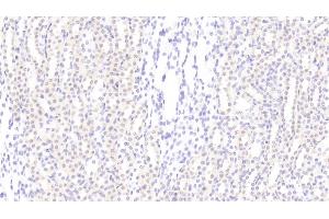 Detection of CCND1 in Rat Kidney Tissue using Polyclonal Antibody to Cyclin D1 (CCND1) (Cyclin D1 抗体  (AA 1-295))