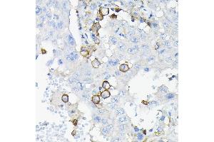 Immunohistochemistry (IHC) image for anti-Leukocyte Immunoglobulin-Like Receptor, Subfamily B (With TM and ITIM Domains), Member 4 (LILRB4) (AA 22-259) antibody (ABIN6143221)