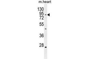 TBC14 Antibody (Center) western blot analysis in mouse heart tissue lysates (35µg/lane). (TBC1D14 抗体  (Middle Region))