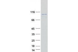 Western Blotting (WB) image for Dipeptidyl-Peptidase 6 (DPP6) (Transcript Variant 3) protein (Myc-DYKDDDDK Tag) (ABIN2719494)