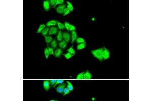 Immunofluorescence analysis of A549 cells using Rad51D Polyclonal Antibody (RAD51D 抗体)