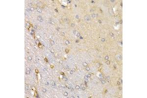 Immunohistochemistry of paraffin-embedded rat brain using SFRP2 antibody (ABIN6131355, ABIN6147675, ABIN6147677 and ABIN6221030) at dilution of 1:200 (40x lens). (SFRP2 抗体  (AA 25-295))