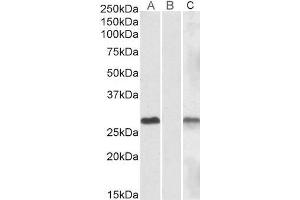 Lane A - ABIN570830 (1µg/ml) staining of HEK293 overexpressing Human DYDC1 lysate (10µg protein in RIPA buffer) Lane B - ABIN570830 (1µg/ml) staining of HEK293 mock-transfected lysate (10µg protein in RIPA buffer).