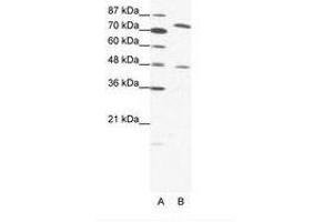 Image no. 1 for anti-Zinc Finger Protein 225 (ZNF225) (AA 127-176) antibody (ABIN202877) (ZNF225 抗体  (AA 127-176))